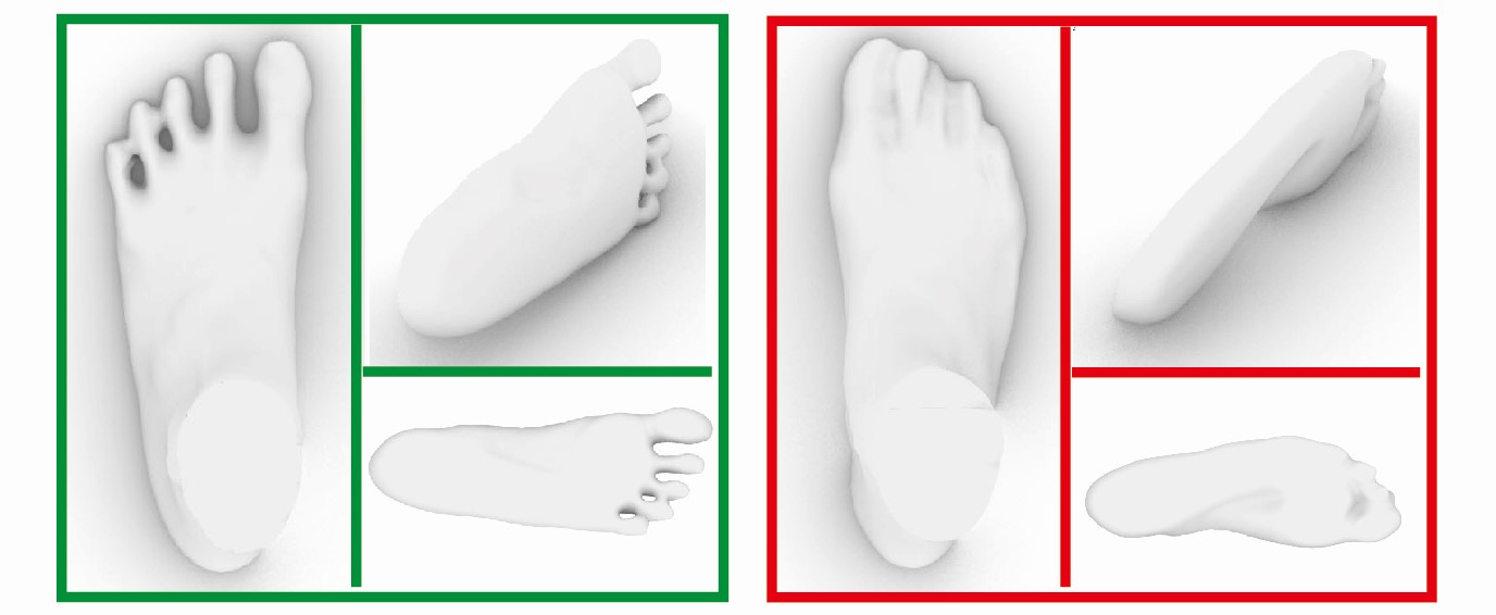足型掃描機的報告，正確的穿鞋習慣，左腳姆趾自然伸展，右腳姆趾受到擠壓