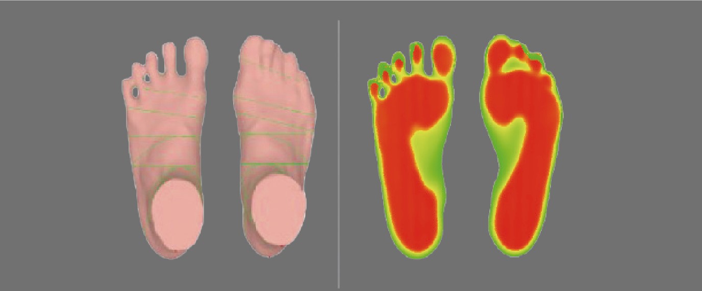 足型掃描機的報告圖形，掃出3D的足部模型，足底壓力的顏色