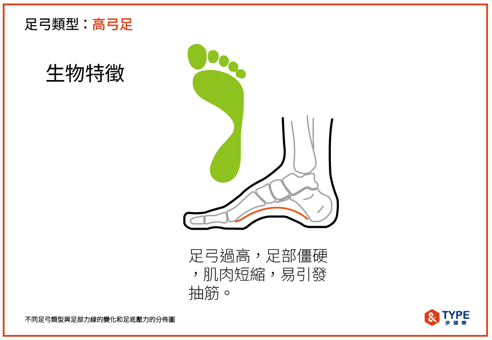 高弓足的特徵