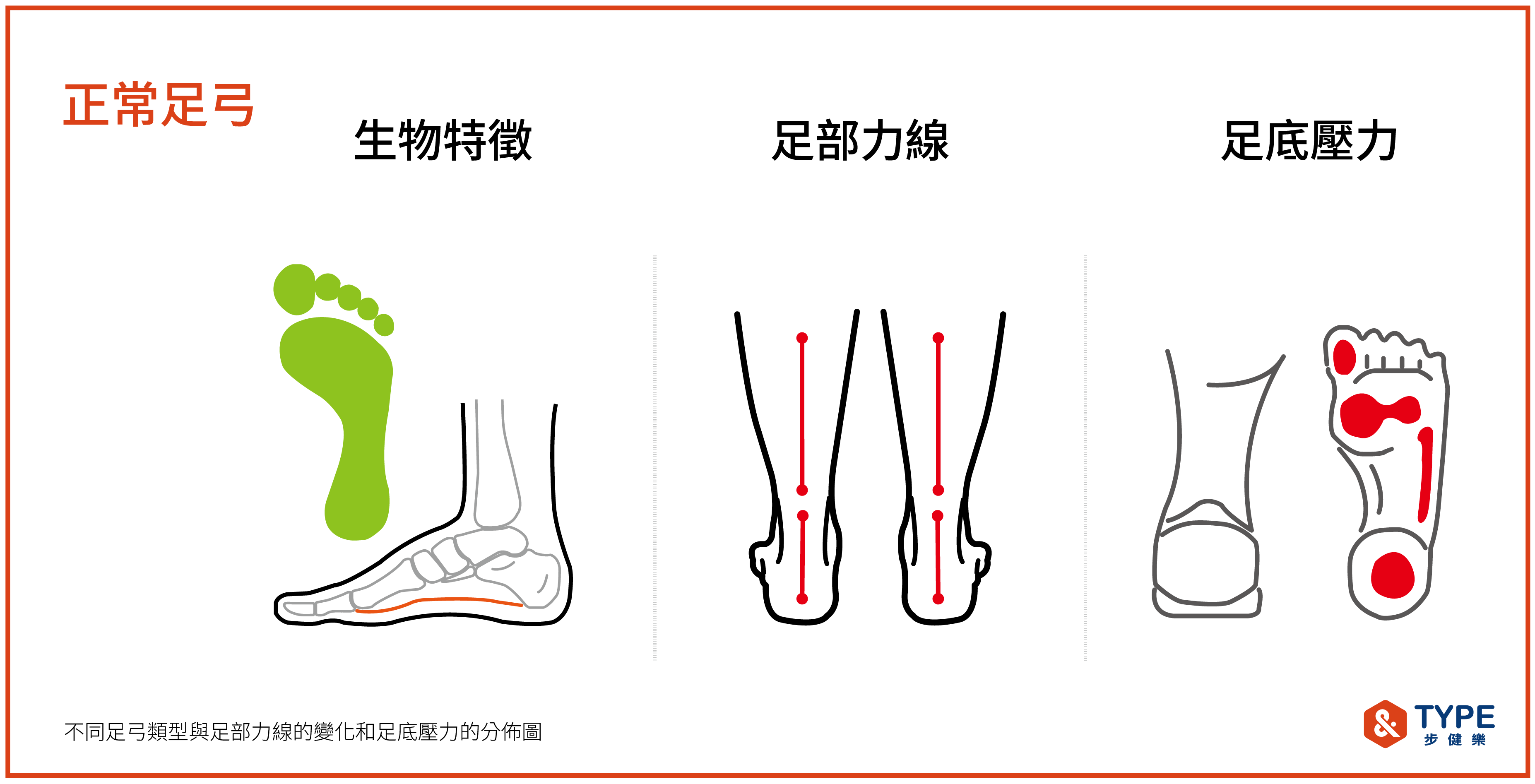健康足弓的特徵