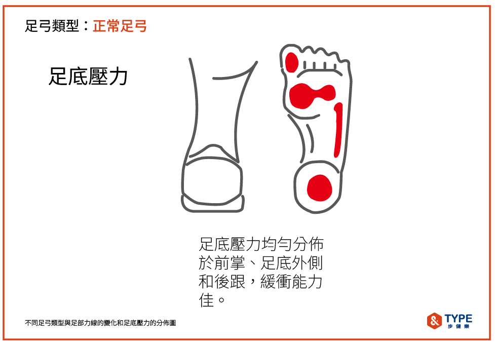 健康足弓的足底壓力分佈方式