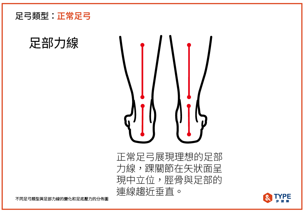 健康足弓的足部力線